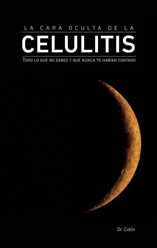 La Cara Oculta de la Celulitis. Todo lo que no sabes y que nunca te habían contado