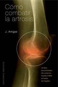 Como Combatir La Artrosis